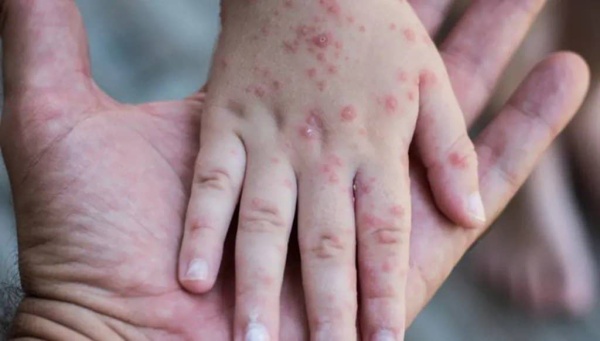 مأرب تعلن حالة الطوارئ لمواجهة خطر متصاعد مأرب تعلن حالة الطوارئ لمواجهة خطر متصاعد