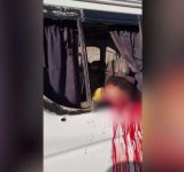 جريمة نكراء يرتكبها العدو السعودي في التربة بتعز جريمة نكراء يرتكبها العدو السعودي في التربة بتعز