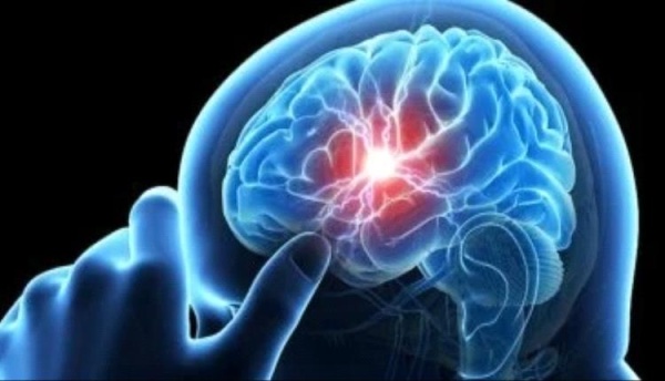 تعرف على أسباب ألزهايمر التي لا تعلمها ماذا يحدث داخل الدماغ