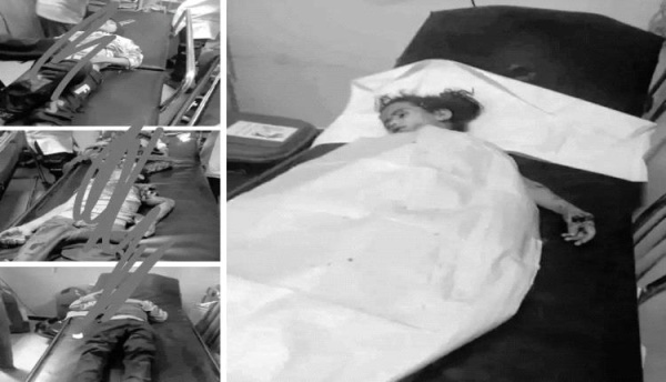 فاجعة مروعة في الضالع 4 أطفال شهداء و8 جرحى بانفجار مخلفات حوثية محدث فاجعة مروعة في الضالع 4 أطفال شهداء و8 جرحى بانفجار مخلفات حوثية محدث