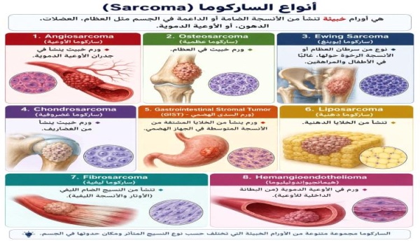 استشاري طب الأورام والعلاج الكيماوي شهر يوليو شهر التوعية بسرطان السلركوما استشاري طب الأورام والعلاج الكيماوي شهر يوليو شهر التوعية بسرطان السلركوما