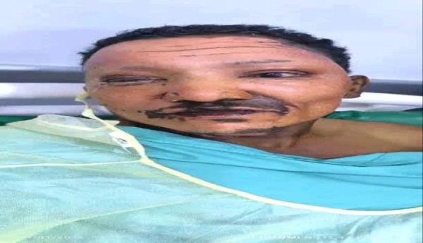نداء إنقدوا حياة جريح حرب نداء إنقدوا حياة جريح حرب