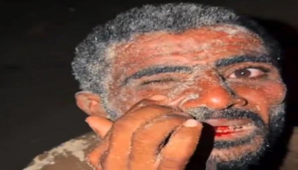 المكلا العنف يسود مهرجان البلدة المكلا العنف يسود مهرجان البلدة