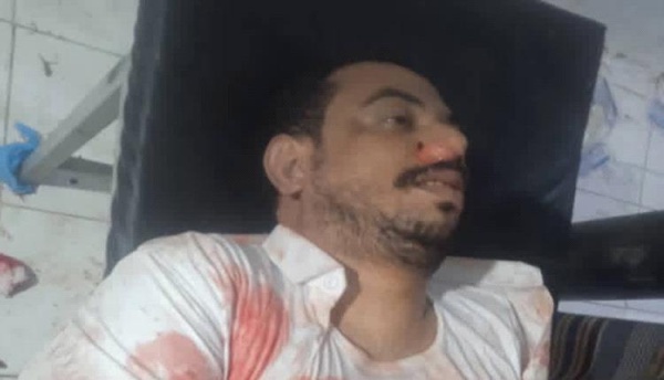 مالك محطات للمحروقات في حضرموت يلقى حتفه في كمين مسلح في أبين مالك محطات للمحروقات في حضرموت يلقى حتفه في كمين مسلح في أبين