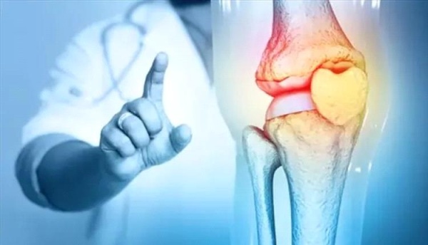 نصائح لحماية العظام في الشتاء تعرف عليها نصائح لحماية العظام في الشتاء تعرف عليها