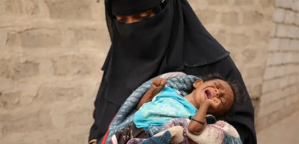 الحوثيون يقودون أكبر عملية تدمير لقطاع الصحة في اليمن تقرير يكشف التفاصيل