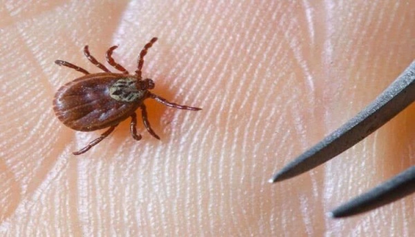 لدغة قرادة ت نهي حياة رجل تركي في 3 أيام فقط لدغة قرادة ت نهي حياة رجل تركي في 3 أيام فقط