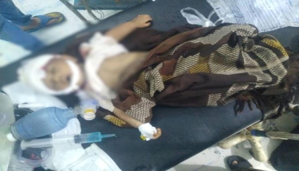شبكة حقوقية الحوثيون مسؤولون عن مقتل وإصابة أكثر من 12 6 ألف طفل يمني شبكة حقوقية الحوثيون مسؤولون عن مقتل وإصابة أكثر من 12 6 ألف طفل يمني