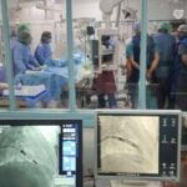 لأول مرة في تونس نجاح زرع ناظمة قلب دون أسلاك بمستشفى الهادي شاكر بصفاقس