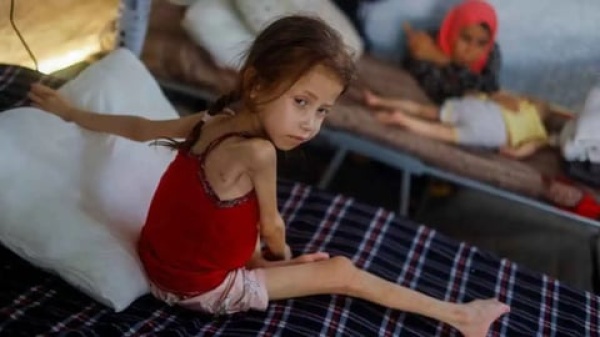 epidemic disaster in gaza 5 000 cases of chickenpox per week epidemic disaster in gaza 5 000 cases of chickenpox per week