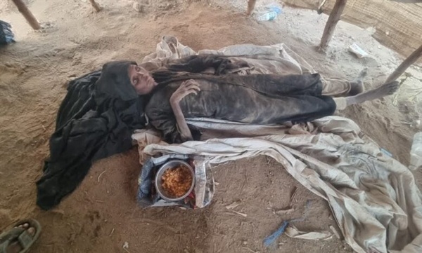 وفاة امرأة مسنة جوعا في مخيم للنازحين بحجة بعد أسابيع من رحيل زوجها وفاة امرأة مسنة جوعا في مخيم للنازحين بحجة بعد أسابيع من رحيل زوجها