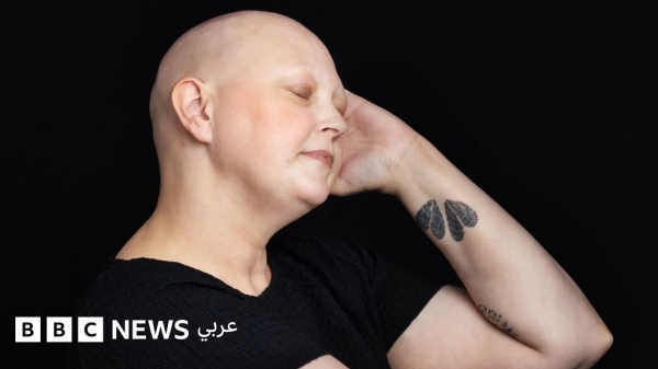 تساقط شعري بسبب العلاج الكيميائي لا يحد د هويتي بل هو رمز لقو تي تساقط شعري بسبب العلاج الكيميائي لا يحد د هويتي بل هو رمز لقو تي