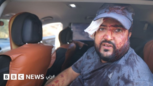 إصابة فلسطينيين وصحافية أمريكية في هجوم لمستوطنين إسرائيليين خلال قطف الزيتون بالضفة الغربية المحتلة
