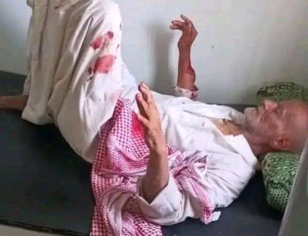 اعتداء مروع على مسن في تعز مطالبات بسرعة ضبط المتهم اعتداء مروع على مسن في تعز مطالبات بسرعة ضبط المتهم