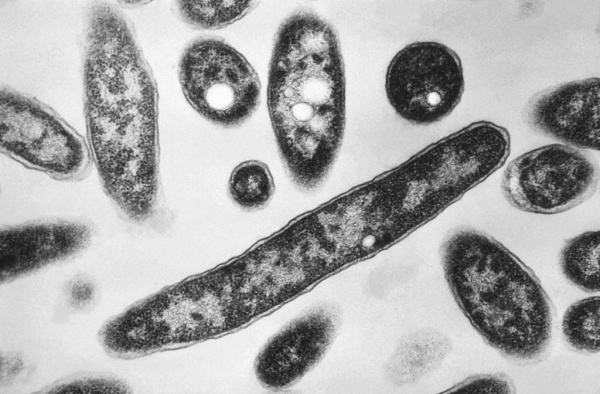تم الإبلاغ عن الوفاة الثانية في تفشي مرض legionnaires في مدينة نيويورك تم الإبلاغ عن الوفاة الثانية في تفشي مرض legionnaires في مدينة نيويورك