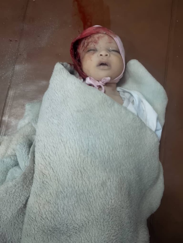 دماء الأطفال مجدد ا في تعز رضيع يفارق الحياة و14 مدني ا ضحايا قصف حوثي دماء الأطفال مجدد ا في تعز رضيع يفارق الحياة و14 مدني ا ضحايا قصف حوثي