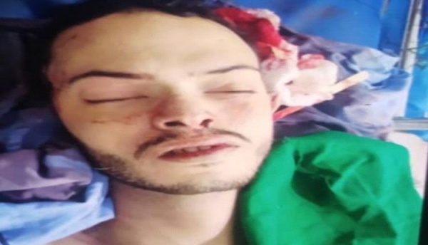 قيادي حوثي يقتل نجله رميا بالرصاص داخل منزله في صنعاء إثر خلافات أسرية