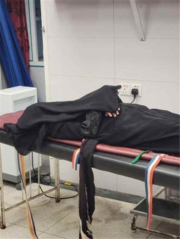 جريمة حوثية مرو عة مقتل امرأة وجنينها بقصف استهدف منازل جنوبي تعز