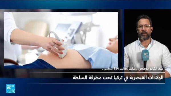 جدل في تركيا بعد توقيف 100 طبيب بسبب ارتفاع الولادات القيصرية جدل في تركيا بعد توقيف 100 طبيب بسبب ارتفاع الولادات القيصرية