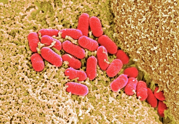 سحب جديد لبراعم الفجل في الولايات المتحدة بسبب e coli والسالمونيلا fda توسع تحذيرا غذائيا