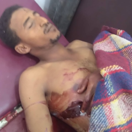 تعز .. مقتل شاب وإصابة آخرين برصاص مسلحين حوثيين