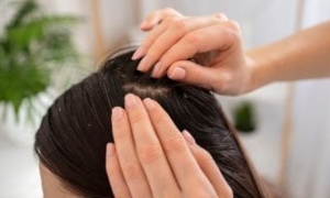 أسباب ظهور قشرة الشعر.. عادات يومية تزيد المشكلة وطرق التعامل معها