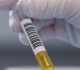 غرامة تصل إلى مليون جنيه عقوبة إدارة مركز تجميع بلازما بدون ترخيص