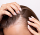 دواء فموي جديد يحقق نتائج واعدة لنمو الشعر في 6 أشهر