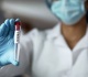 deadly virus outbreak kills 65 in dr congo