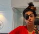 pop singer cancels concert after losing sight in one eye very disorienting and scary
