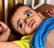 burn like rashes and hunger gaza s children face skin disease crisis