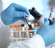 this forgotten blood test can catch cancer early