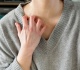 i m a rheumatologist these are the symptoms i ask about before suspecting autoimmune disease