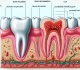 guarding your gums overcoming recession challenges