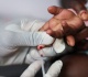 us aid cuts could lead to millions more hiv aids deaths by 2029 un warns