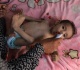 un warns of surge in acute malnutrition among gaza s young children